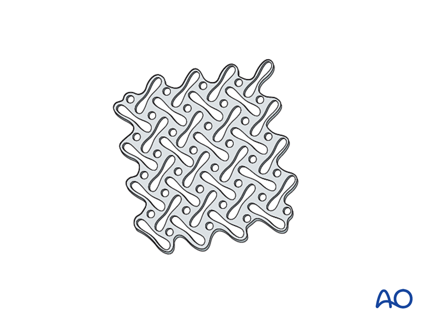 Titanium meshes