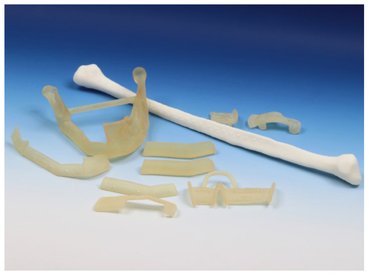 Printed anatomical models and cutting guides