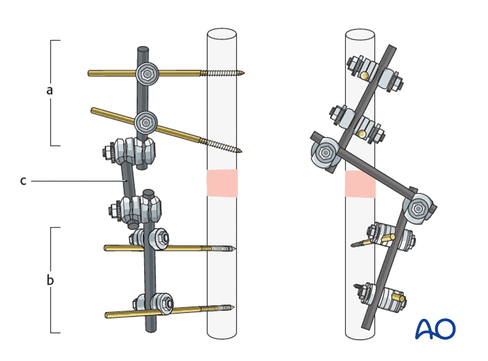 Modular external fixator frame