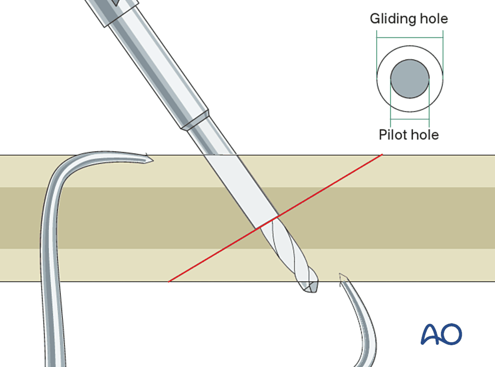 Gliding hole and pilot hole