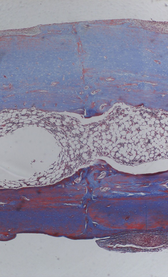 Histology of an osteotomy under a compression plate