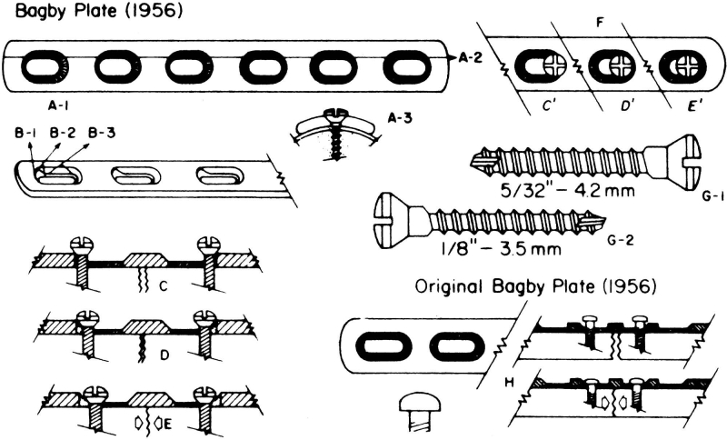 Drawings of the Bagby plate with oval holes