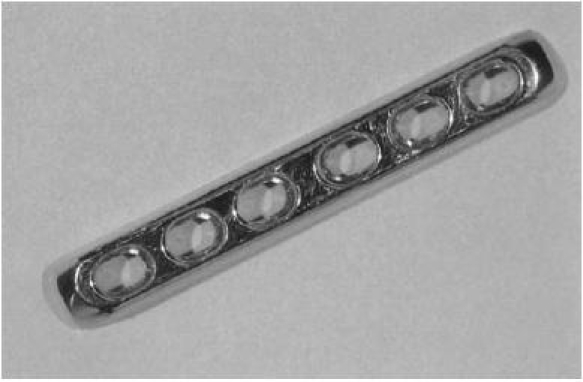 Photograph of a dynamic compression plate