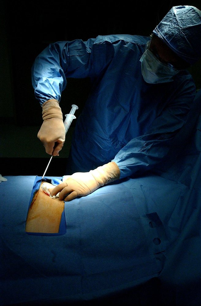 Marrow aspiration from the iliac crest