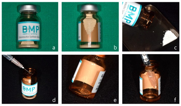 Vial of rhBMP-2 with synthetic bone granules being reconstituted