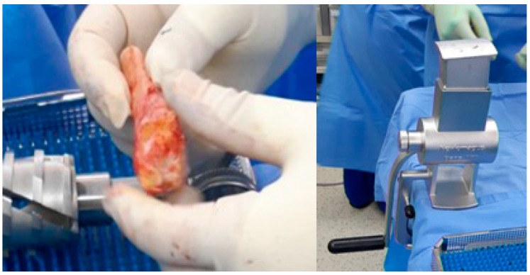 Bone placed in a bone mill