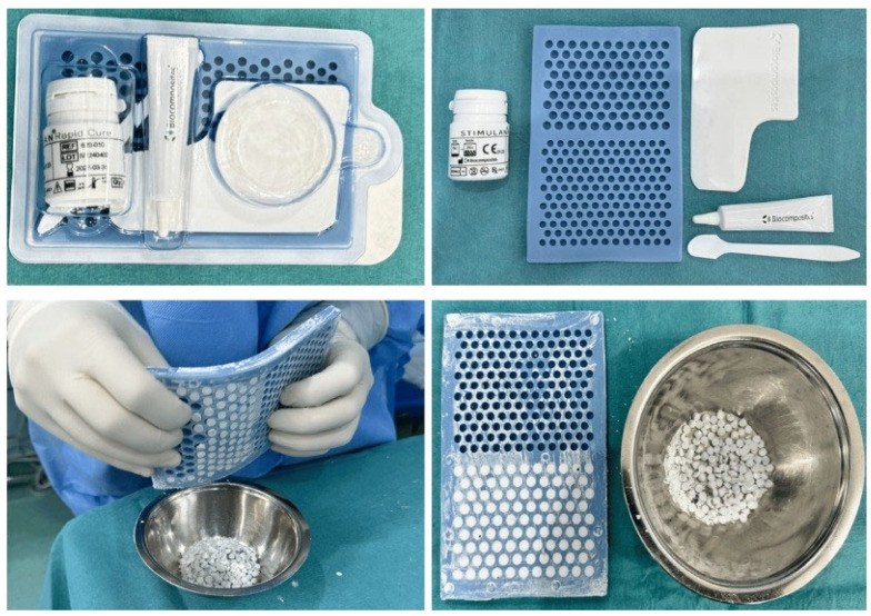 Calcium sulfate bead kit, mould and finished beads