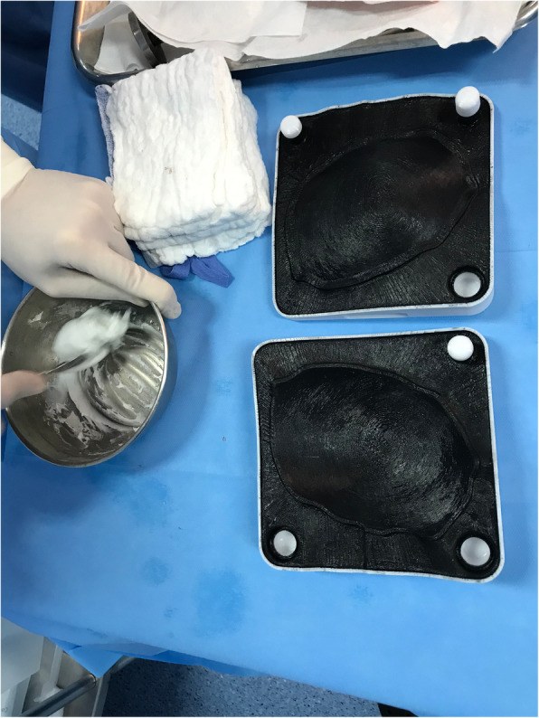 PMMA cement prepared in a two-piece mould