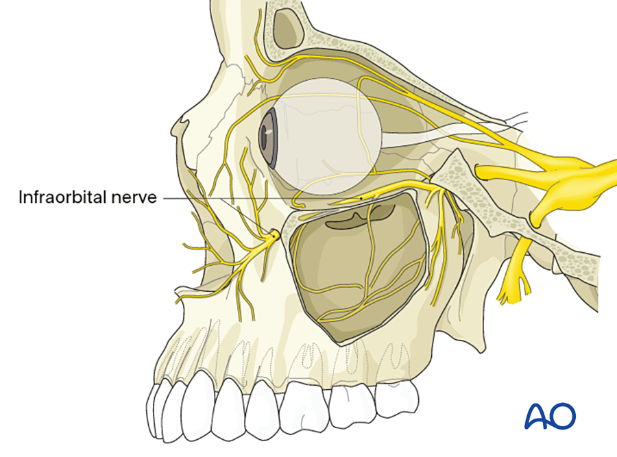 The infraorbital nerve