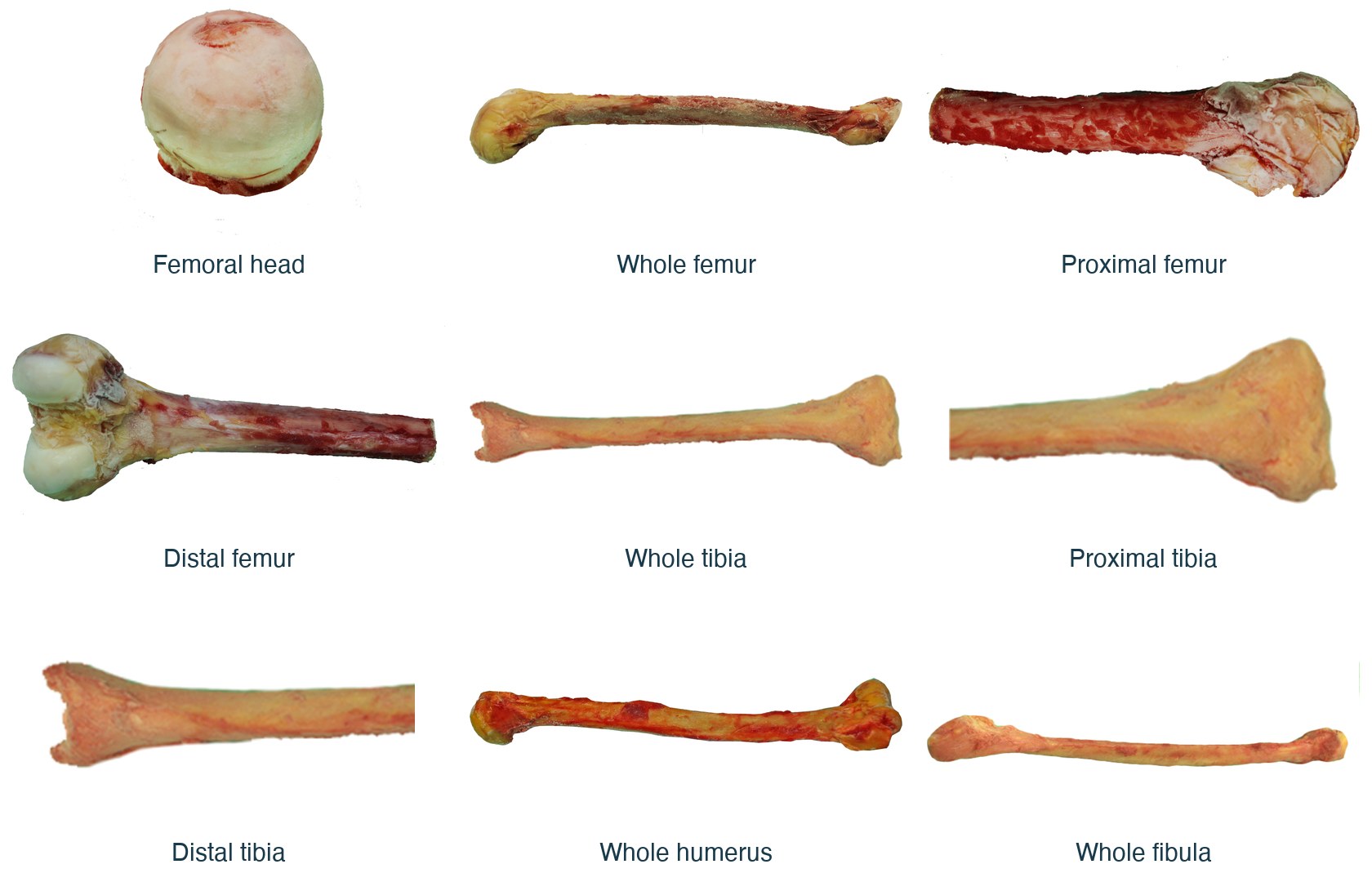 Deep-frozen bone allografts supplied by USM Tissue Bank