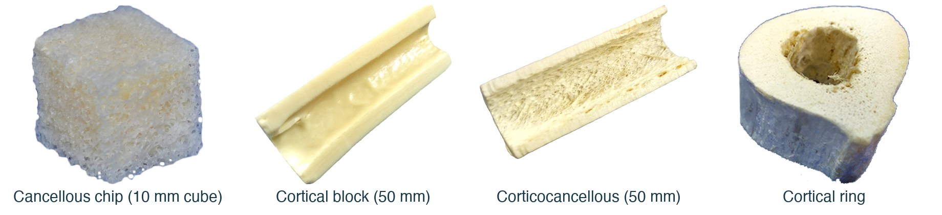 Freeze-dried bone allograft forms: cancellous chip, cortical block, corticocancellous strut and cortical ring